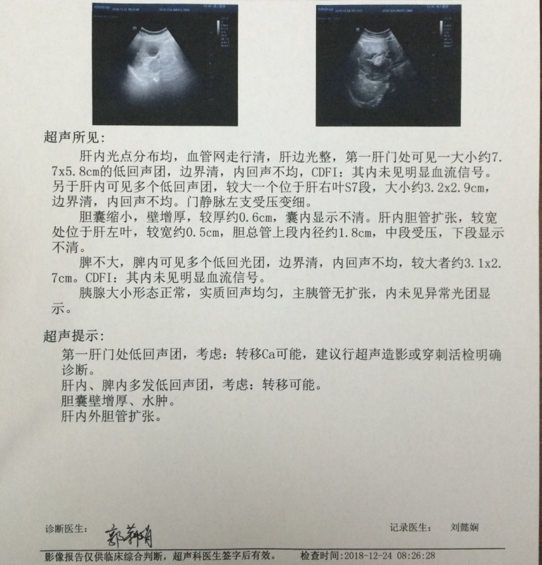 首次B超肝胆脾胰.jpg