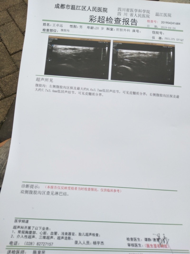 084318qbk4i4i3heknvnv4.jpg