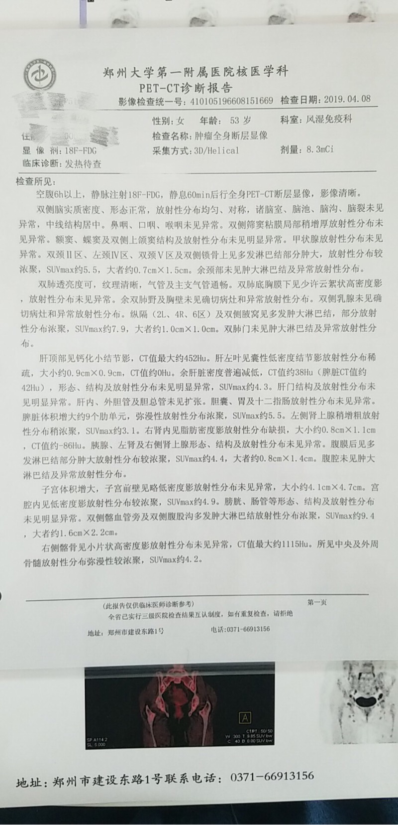 184357icm4ejonmotapncd.jpg