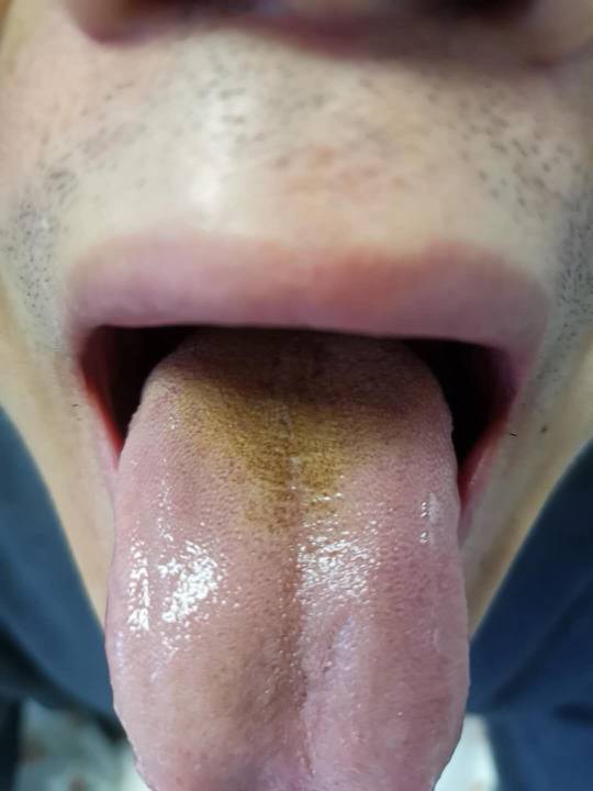 095639tc5umpbcmrbpu6zb.jpg