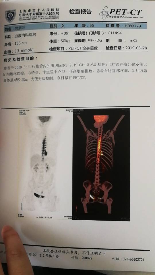 093228u4fuz8d2c4cn8zdz.jpg
