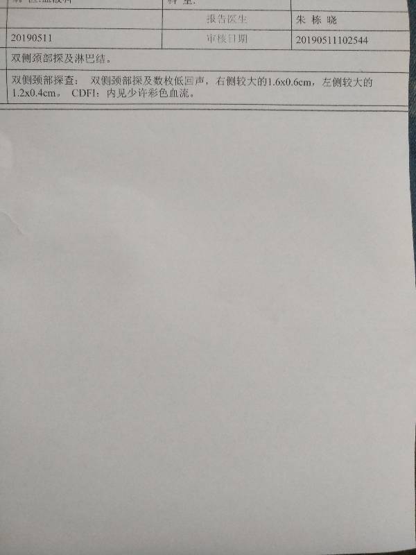 105300eu1g0gu0ii99p20x.jpg