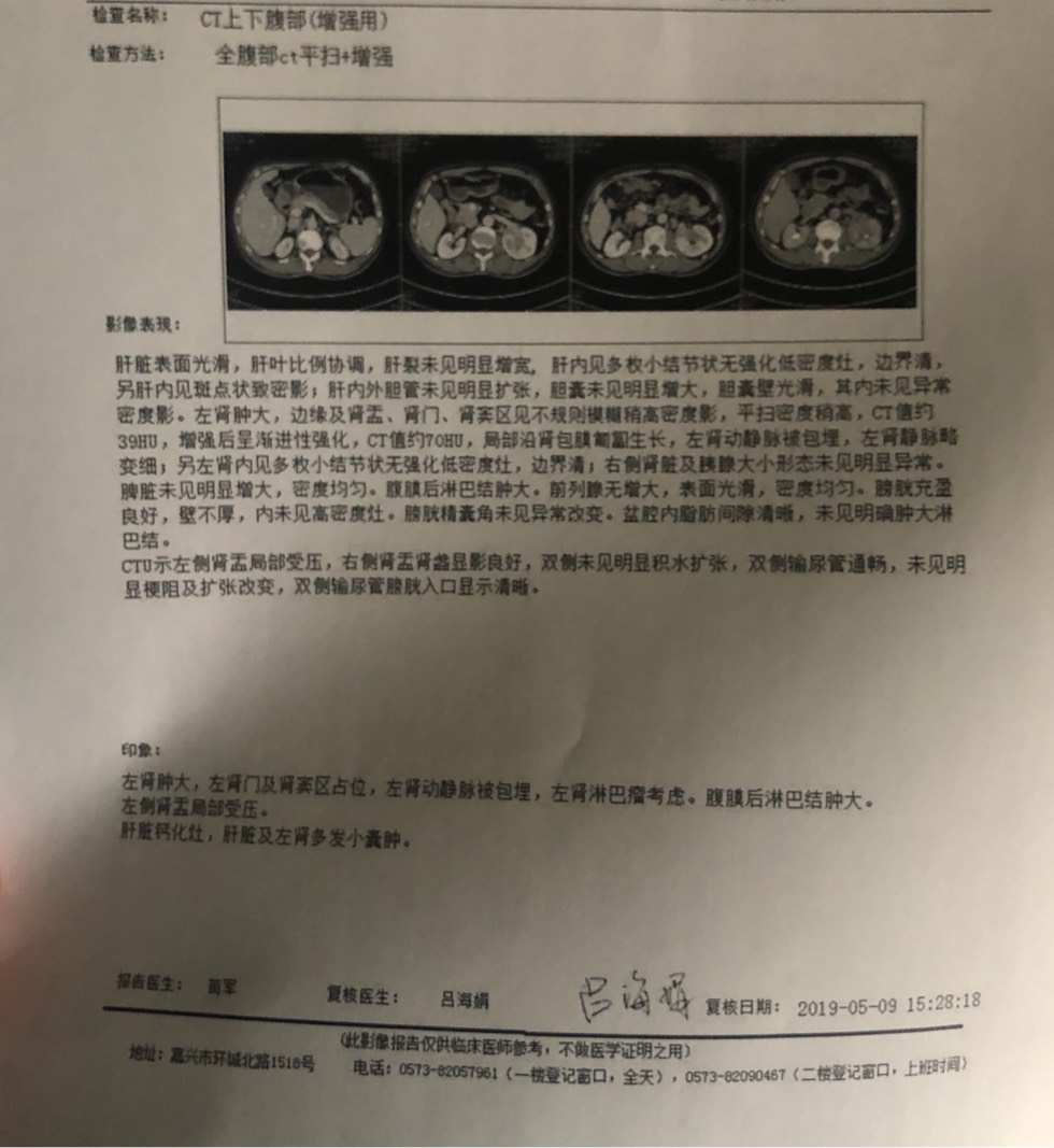 155135yoeodyeeuymm6eei.jpg