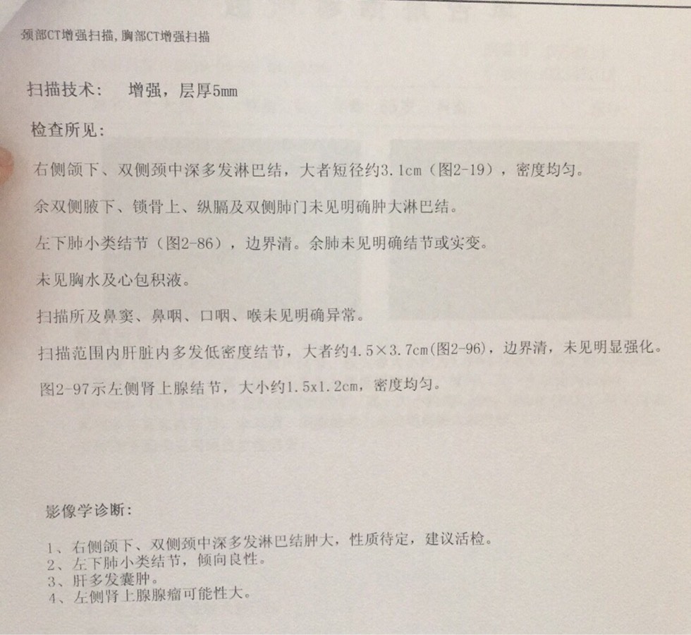 210241om74k7qdvggmxeub.jpg