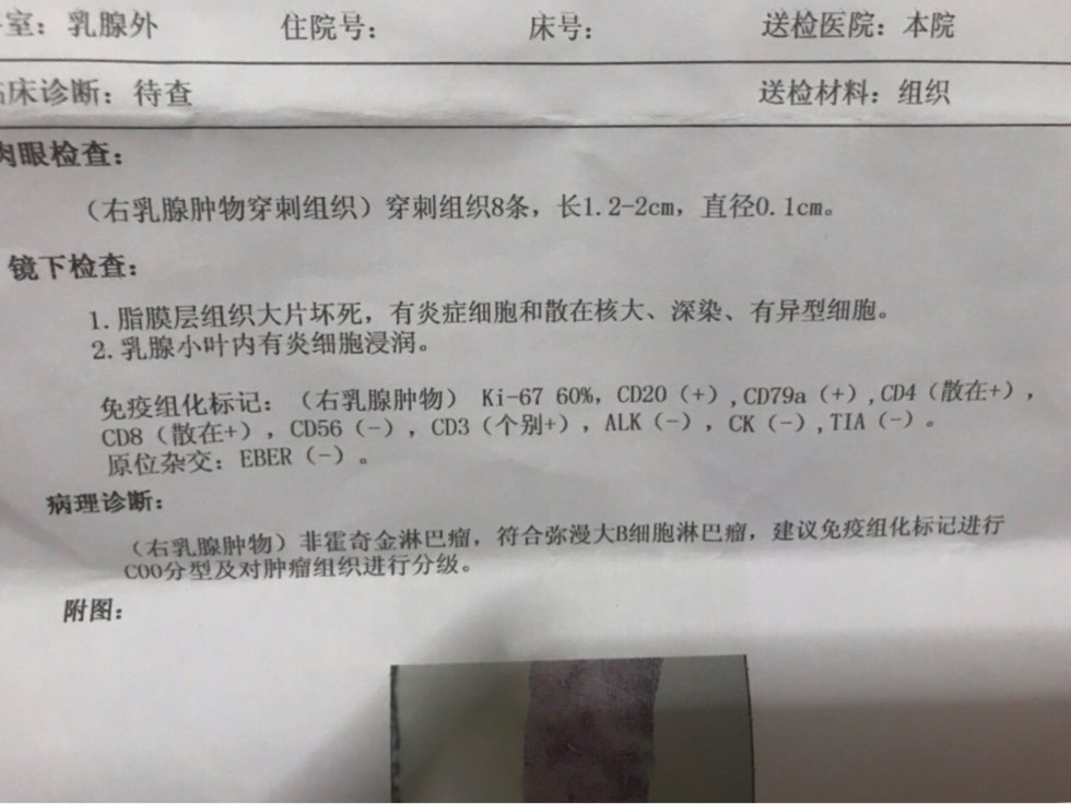 101715ayynnk0710175gql.jpg