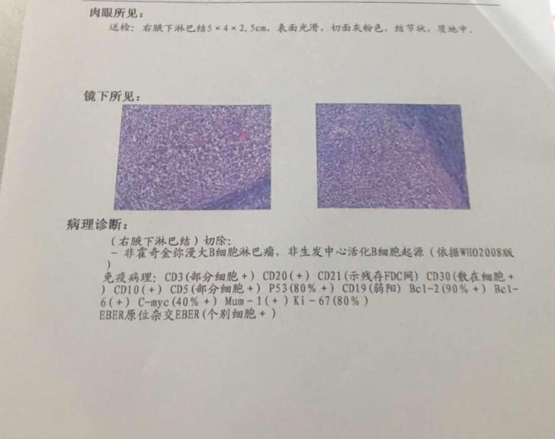病理报告