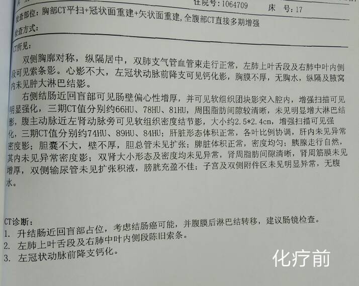 105732phih818g9ie5po95.jpg