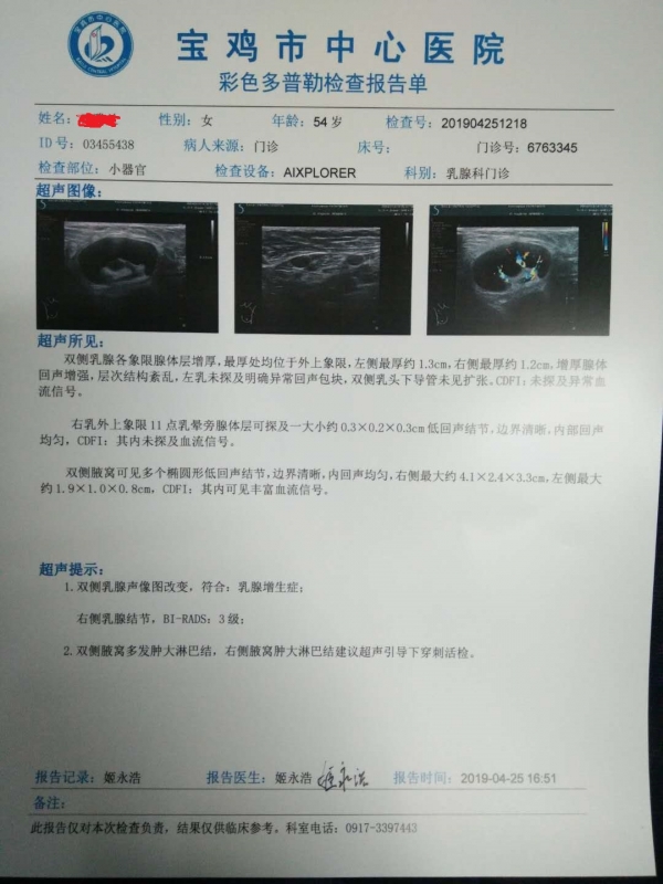 4月的B超