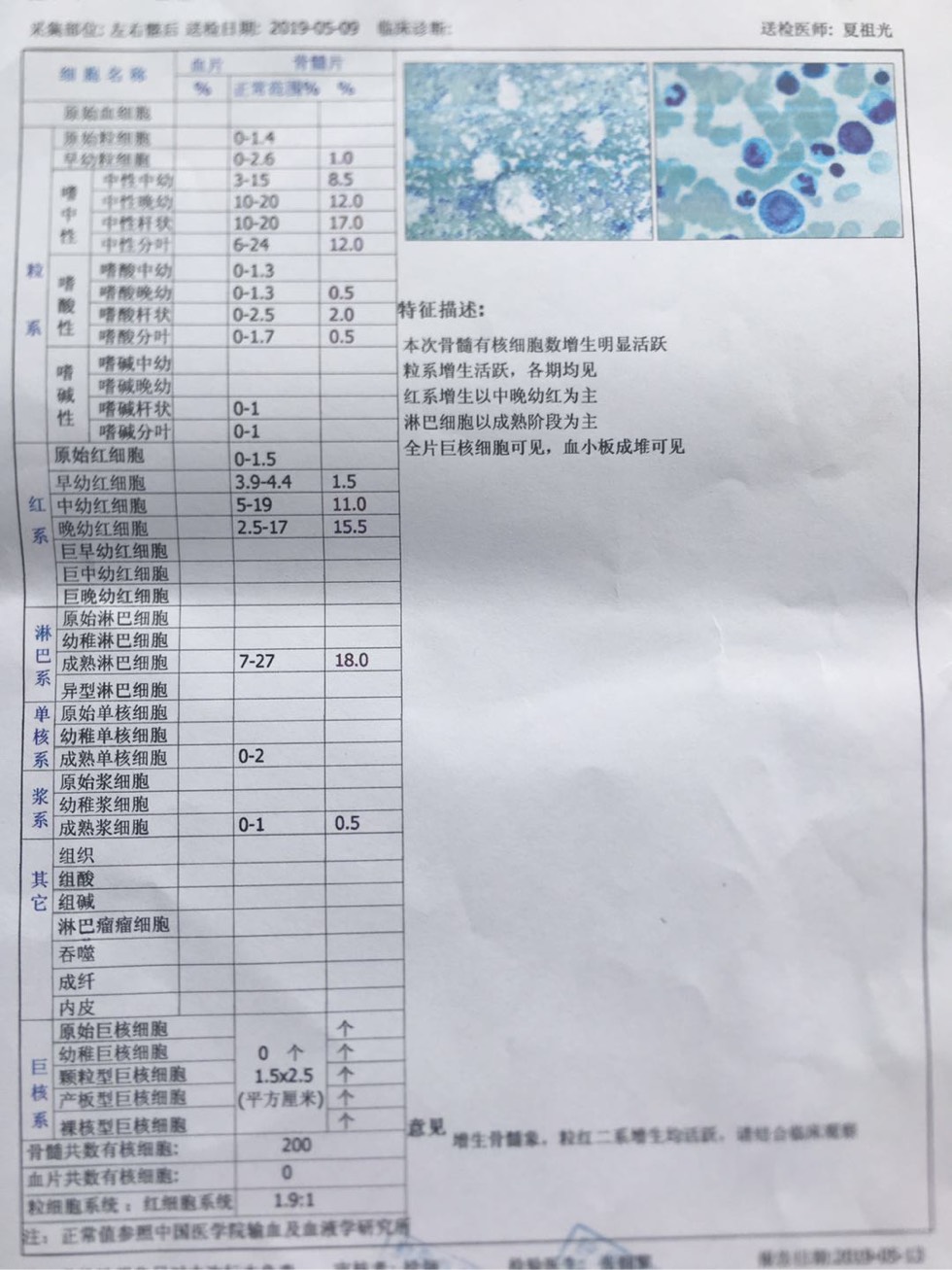 115258nzb14xzbmbh4jqvh.jpg