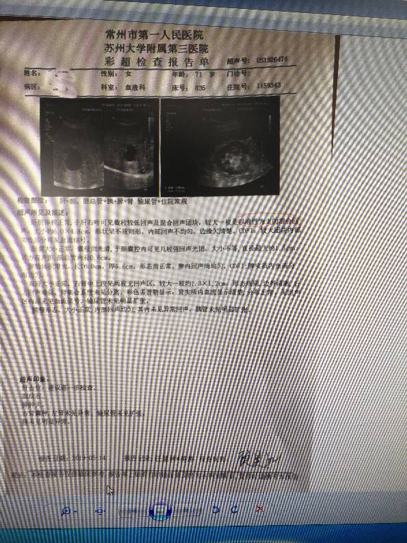 152848lmssdvgi431du3ik.jpg