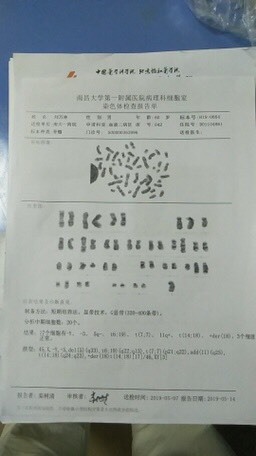 211716ysez93zqp39lz561.jpg