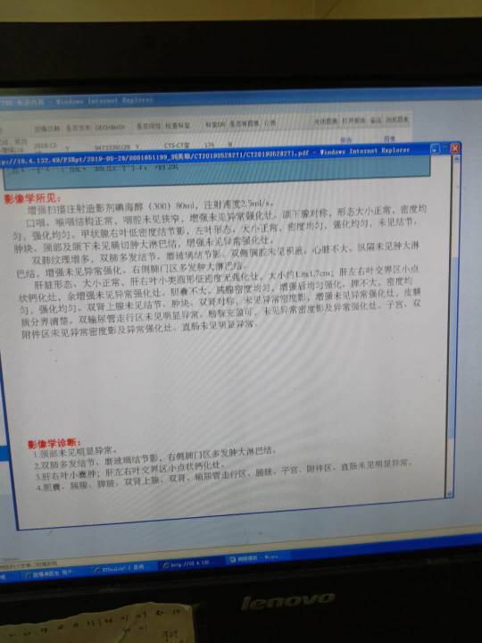 111838nnw2vznk458hff5o.jpg