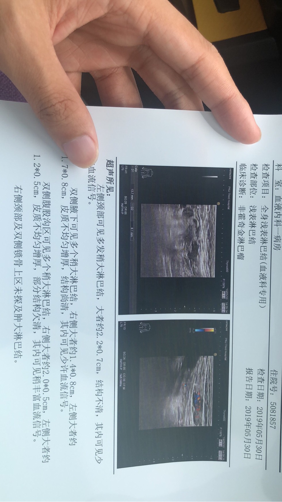 155620cmuimt0zt168pvf3.jpg