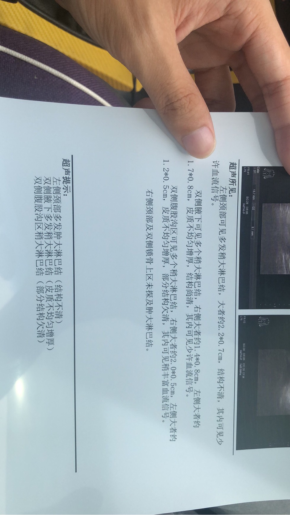 155625w8e1dyse12ss28fy.jpg