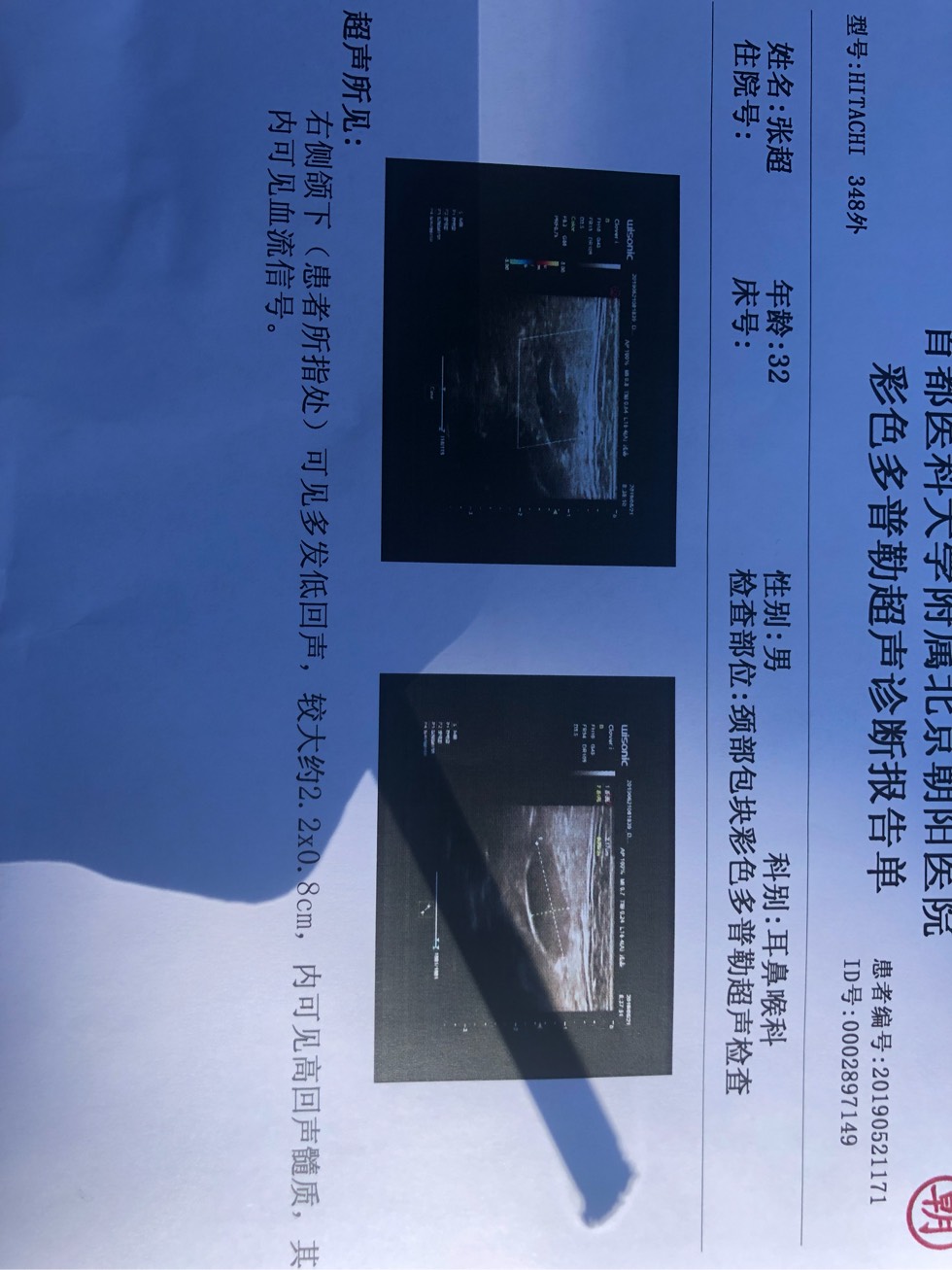 165542jr9ee9eu6zuoozeo.jpg