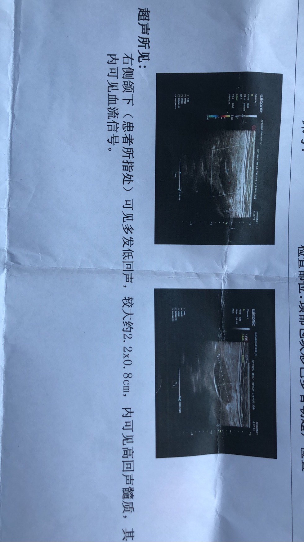 170630vzqs8elk837y7s8e.jpg