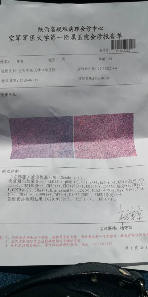 125050c0zfd15hk014ndch.jpg