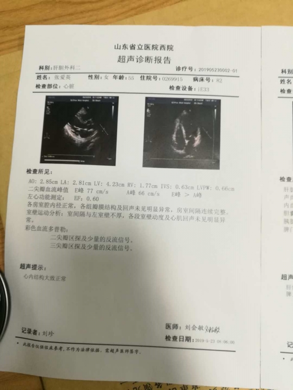 B超3.jpg