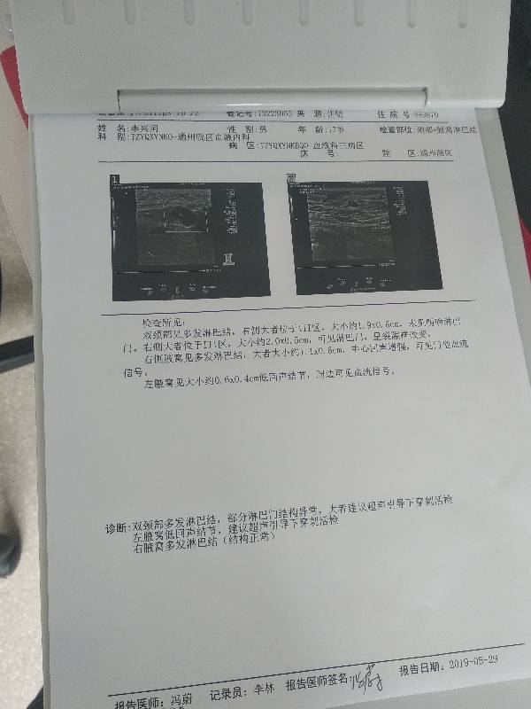 205151t88lxwp7p6dd8473.jpg