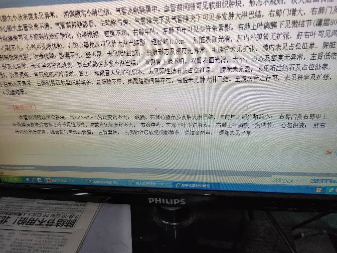 101927ksmb4gz33pcpcp3c.jpg