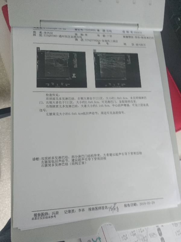 213701krdr0a4voisvk7ko.jpg