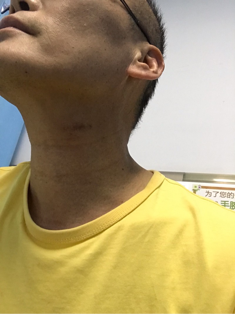125009h4xy1rxbcpixylzc.jpg