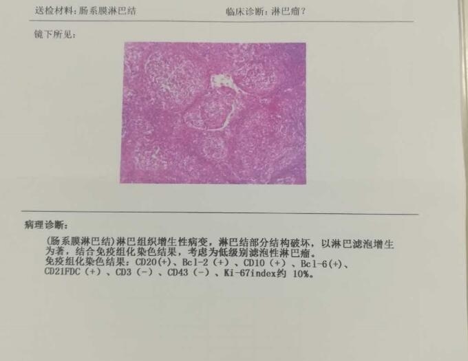病理报告1