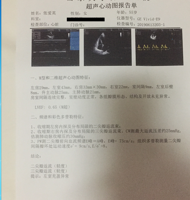 心脏彩超