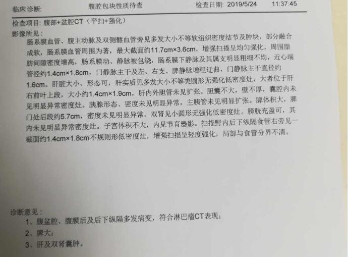 增强CT