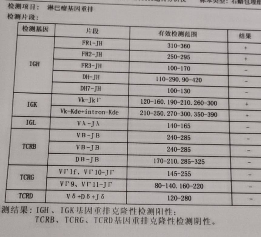 170607v30dccttv4z0tbwv.jpg