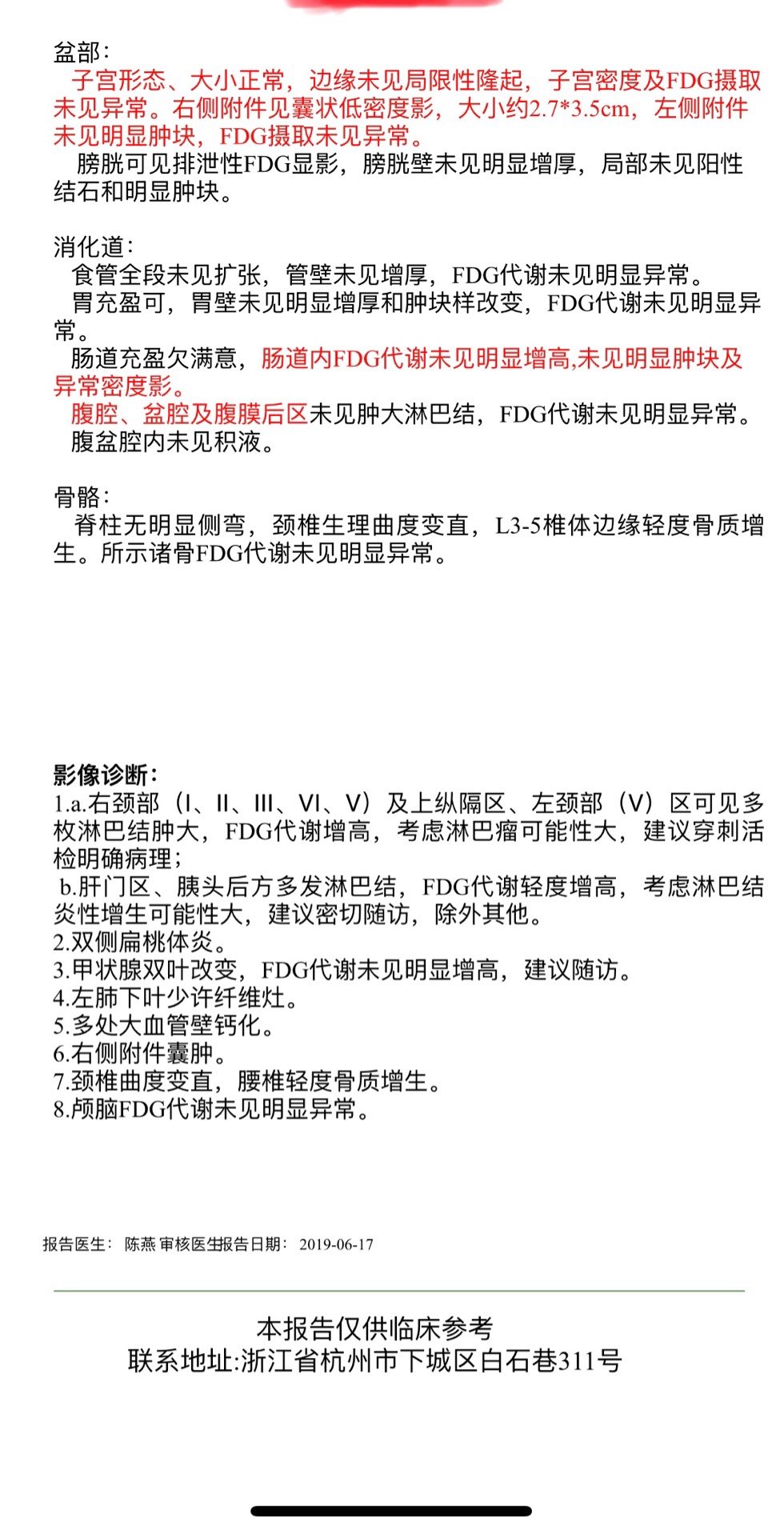 081745ab9bz91nk1qunkqq.jpg