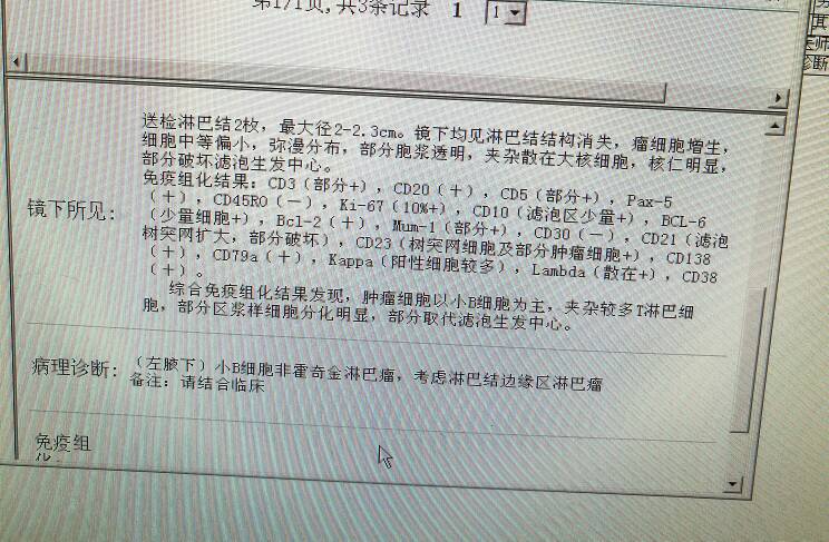 215101ecmx4c8pmla7zypf.jpg