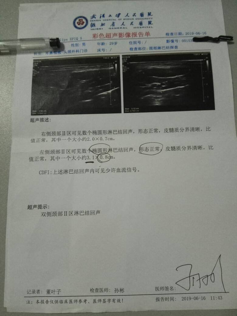 191034pd6wsndd39ndnwsw.jpg