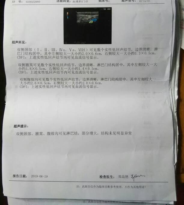 152624yu8phmcvd9m80vtm.jpg