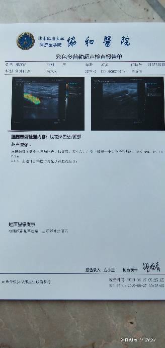 212036s9qc6515ymmq4vn2.jpg