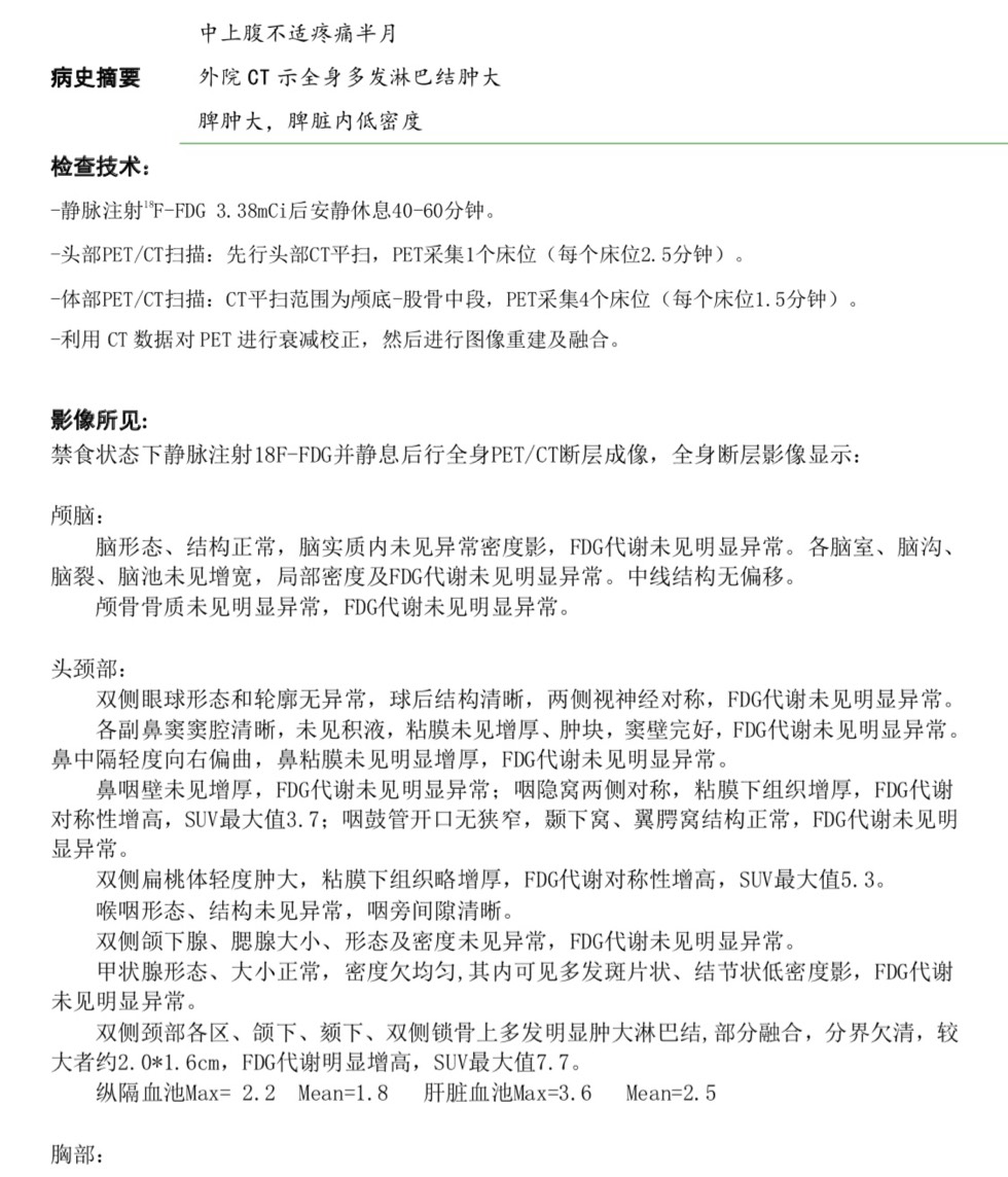 183228grnp71lao14zyyw7.jpg