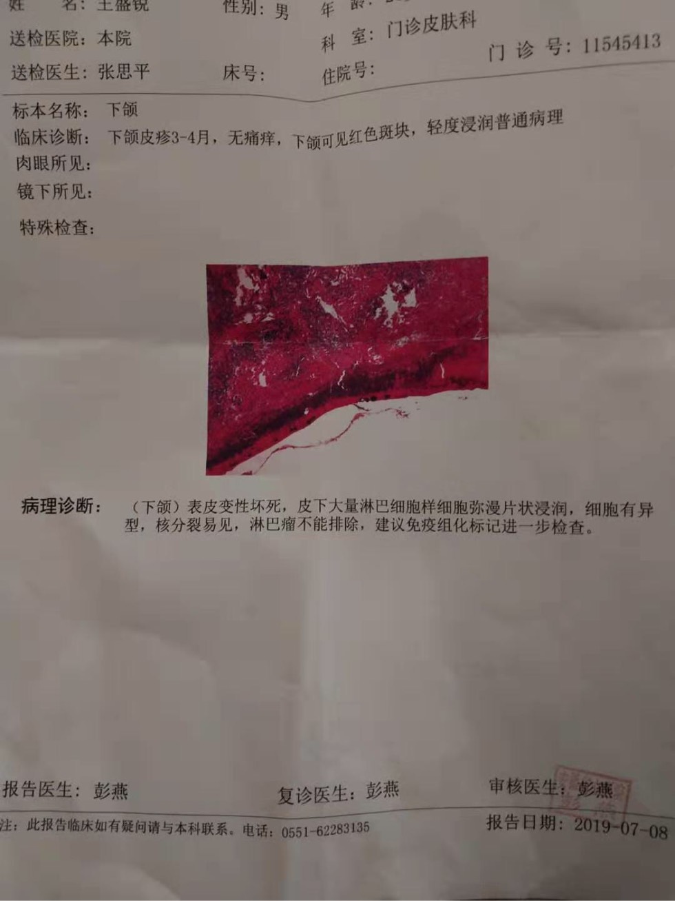 122956naqatyt9pt9k3w9g.jpg