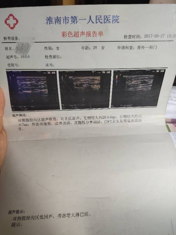 134950te4tqyo24kuo184x.JPG
