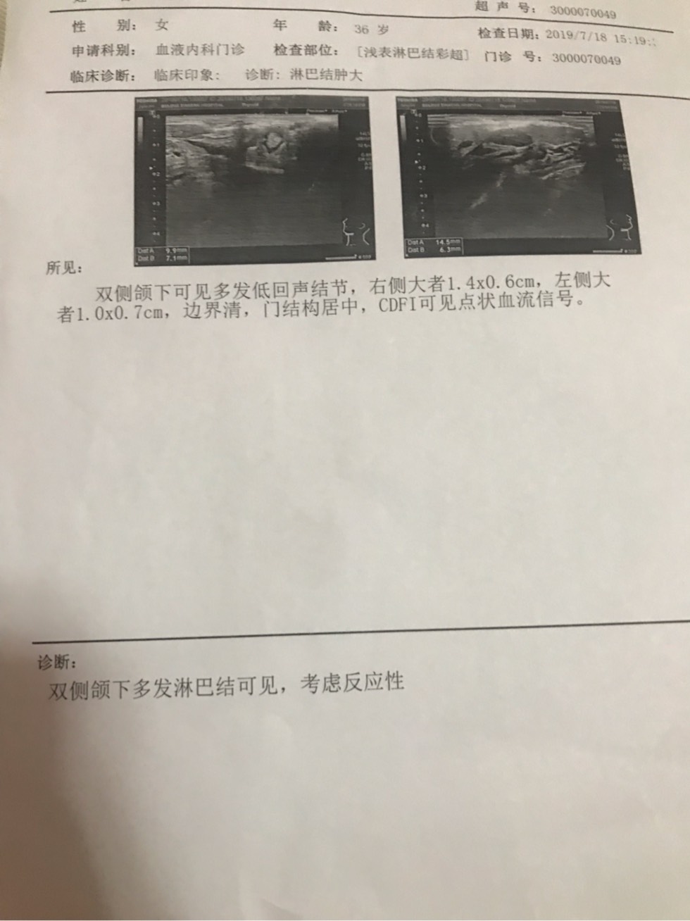 113531ndfdzct6iqidteqt.jpg