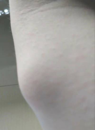 174849uxuukckpdfrgprci.jpeg