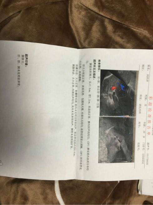 220415eqmqqygnuidq6qku.jpg