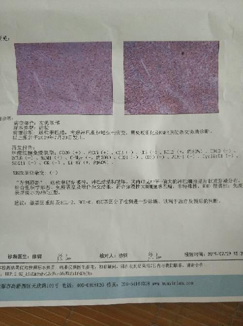 115110n62t7l75g2af656l.jpg