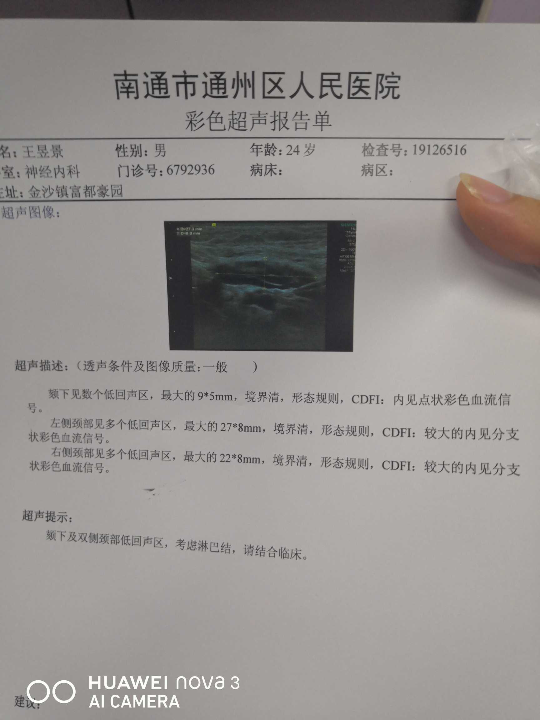 130100tx18f0vd62vd8f8q.jpg