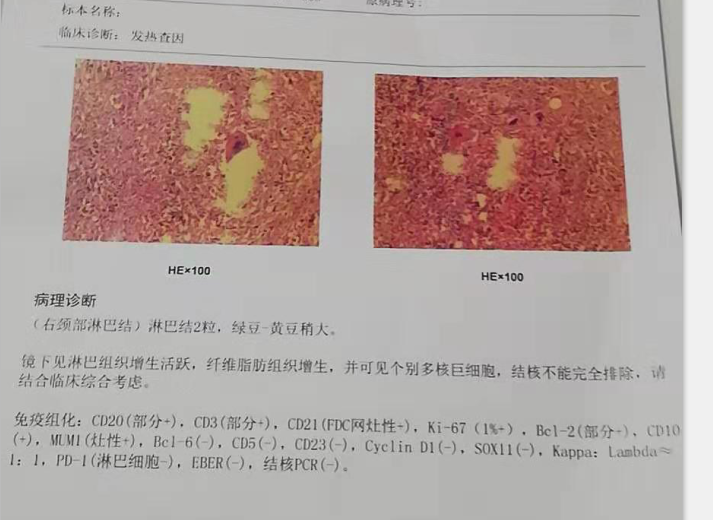 活检报告