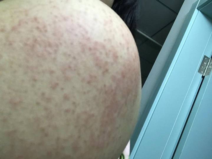 213430fogzzzj1pjbjup1w.jpg