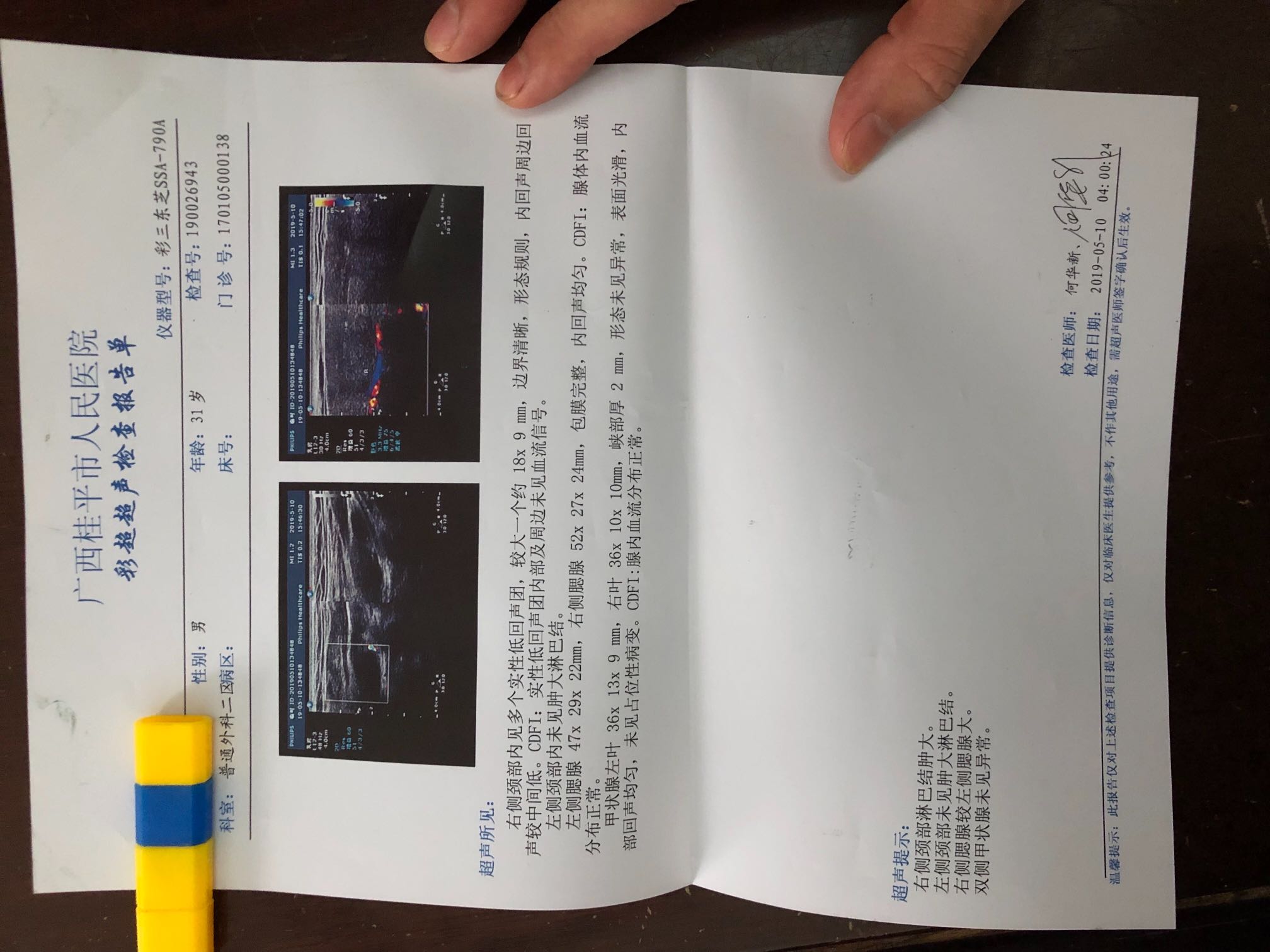 085745du262ud29y98g229.jpeg