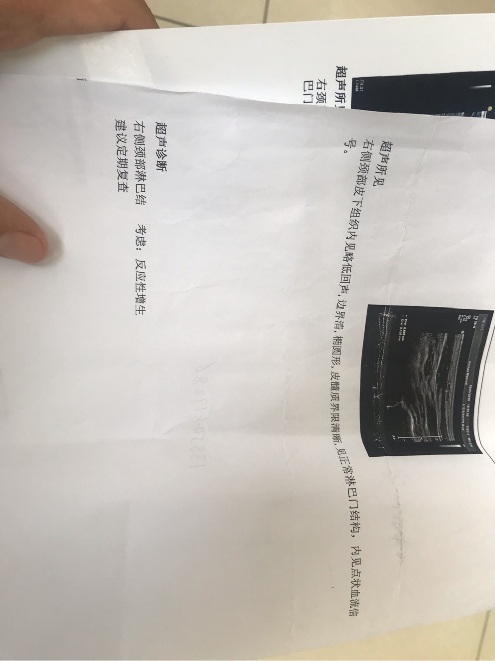 154000o09bko22p1w2pc54.jpg