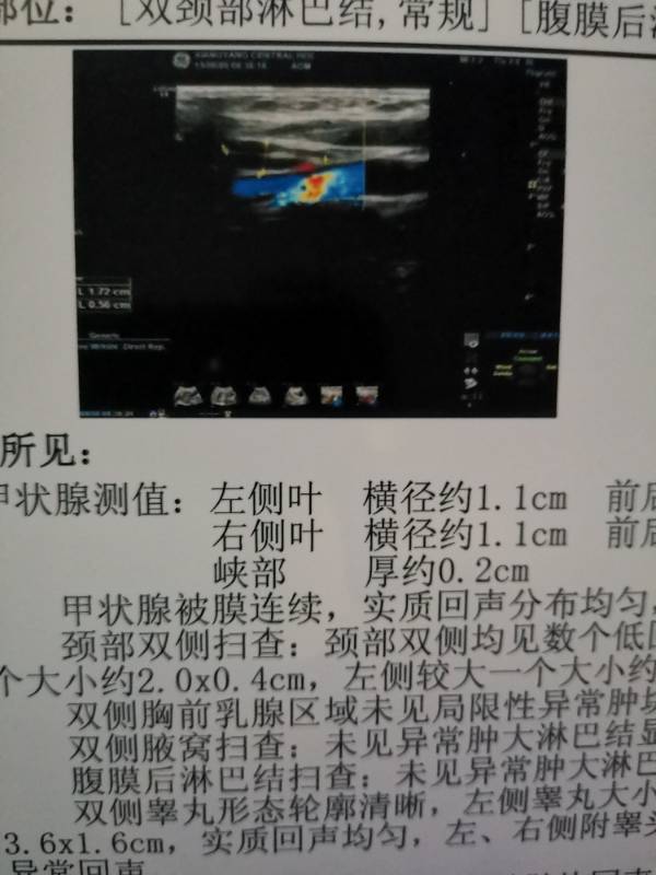 210238oalw0rayaojgrtzo.jpg