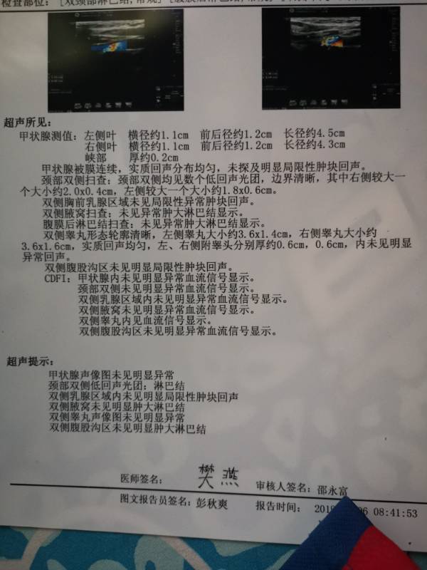 210238oym0g0xd0kepsp7s.jpg