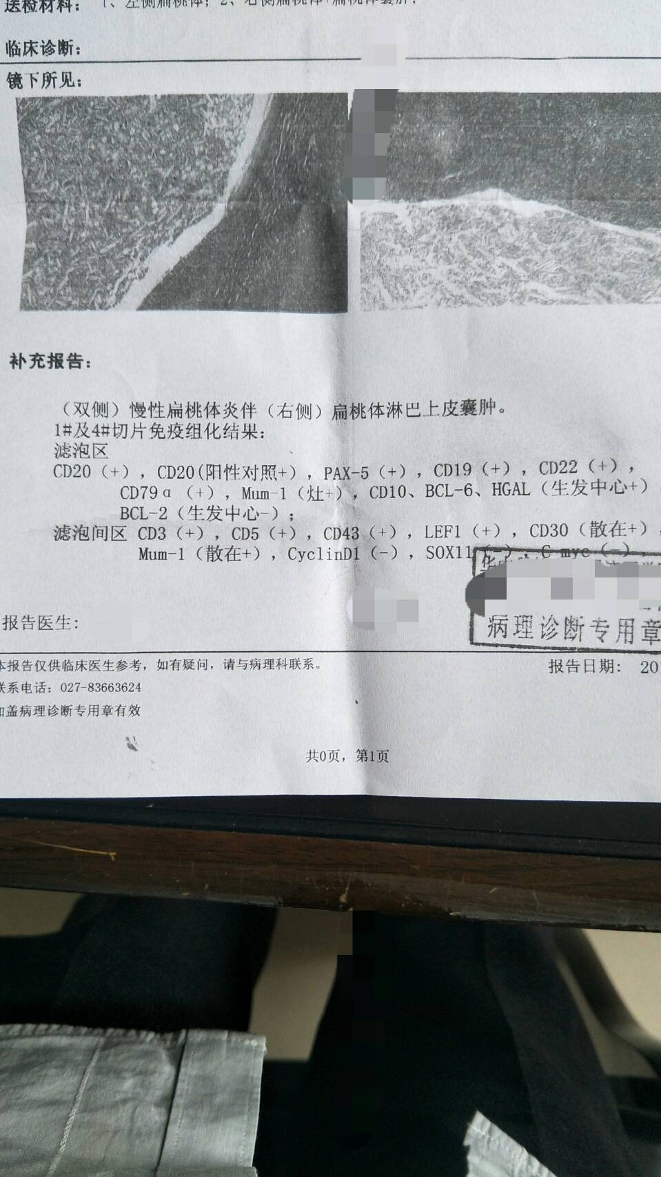 171417zz1vqvuiibd9i139.jpg
